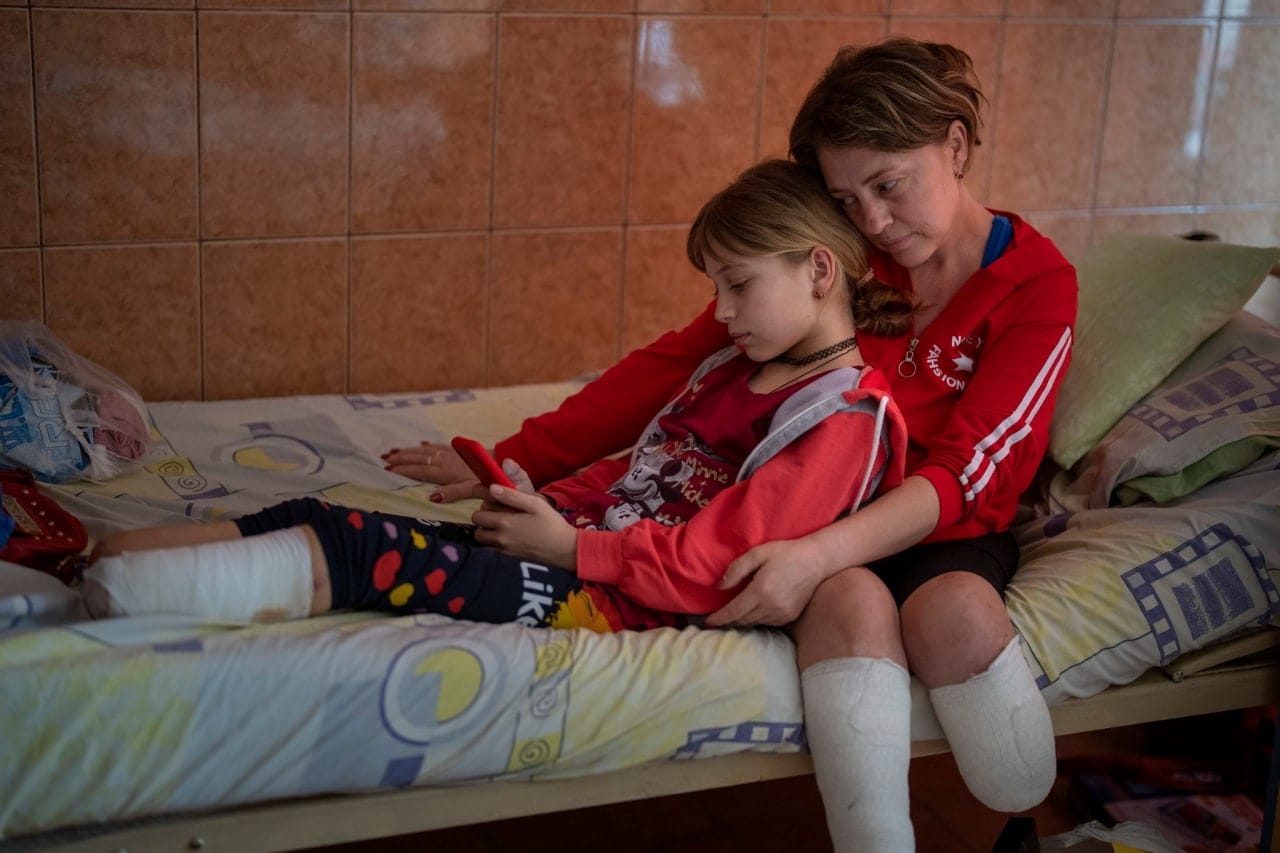 Starka bilder från Ukraina: ”Amputerade lemmar och oändlig smärta i ögonen”